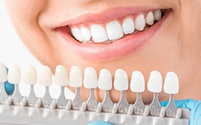 Tìm hiểu về răng sứ
